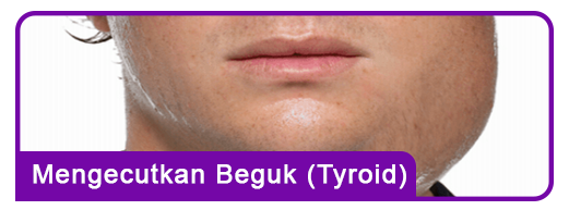 Mengecutkan-Beguk-(Tyroid)-Nur-Syifa